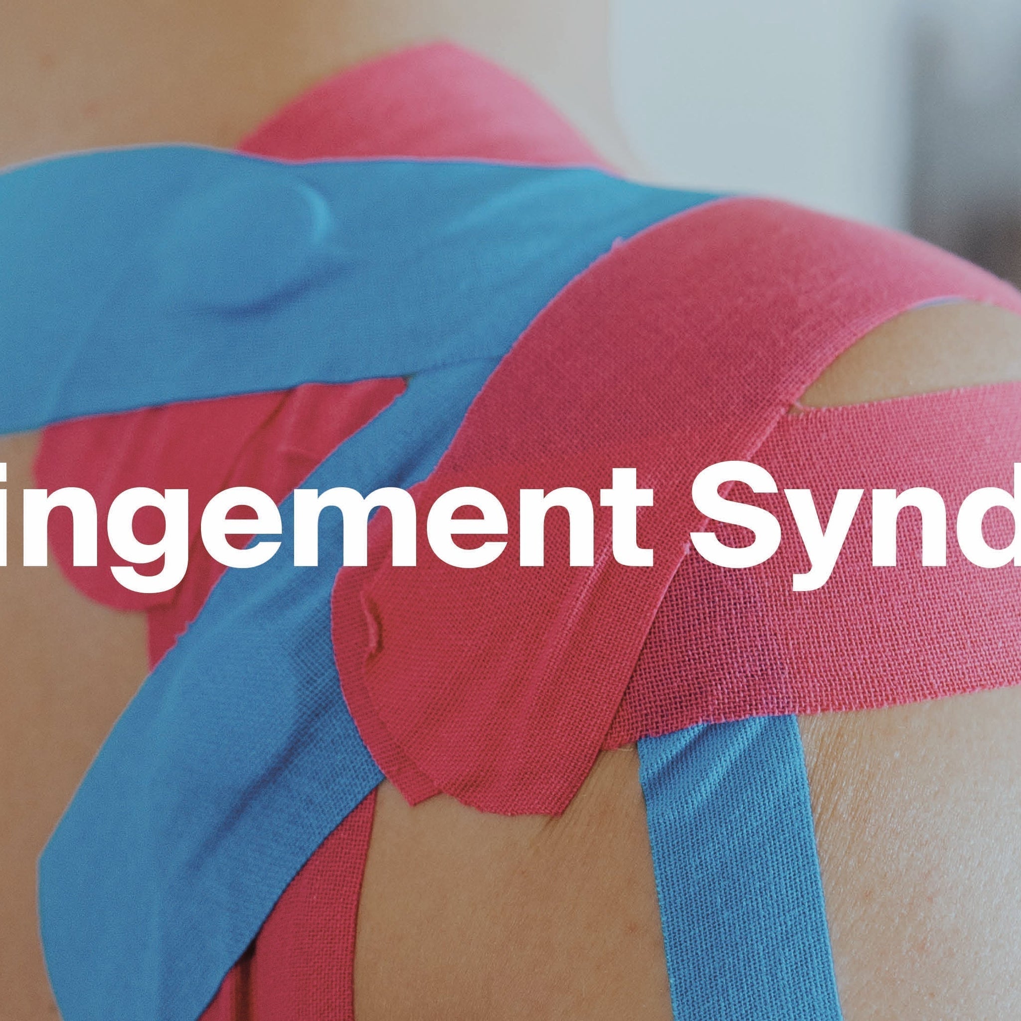 Schulter Impingement - Triggid® - Der Triggerknopf Kinesiotape Anlage